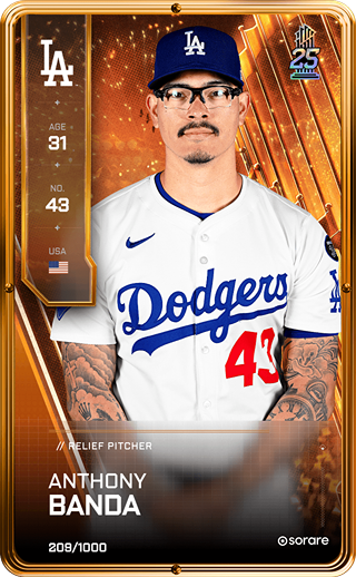 Anthony Banda - limited