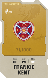 Frankie Kent - limited