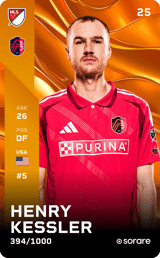 Henry Kessler - limited