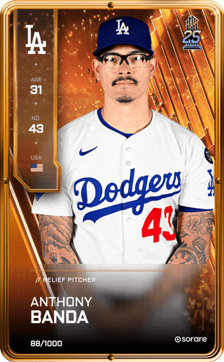 Anthony Banda - limited